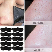 Blackhead Remove Nasal Strips